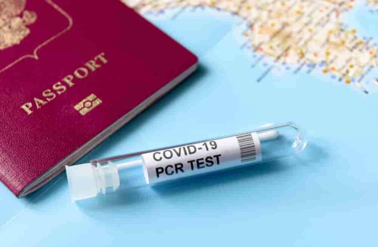 Covid antitest teszt